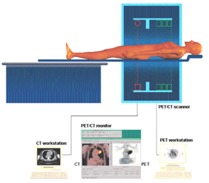 Bild 2: PET/CT Aufnahmeverfahren