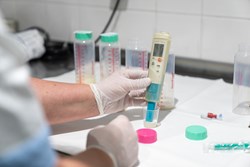 Messung der Muttermilchspende in der Milchküche des Kepler Universitätsklinikums