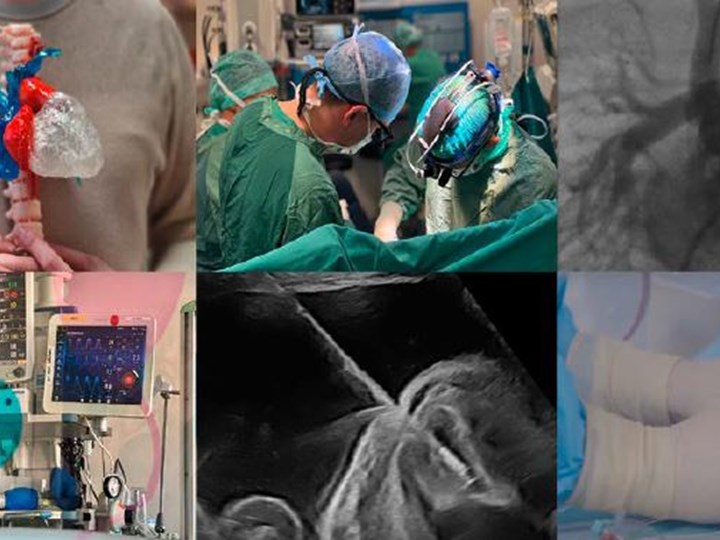 Collage aus Tätigkeiten im Kinderherz Zentrum