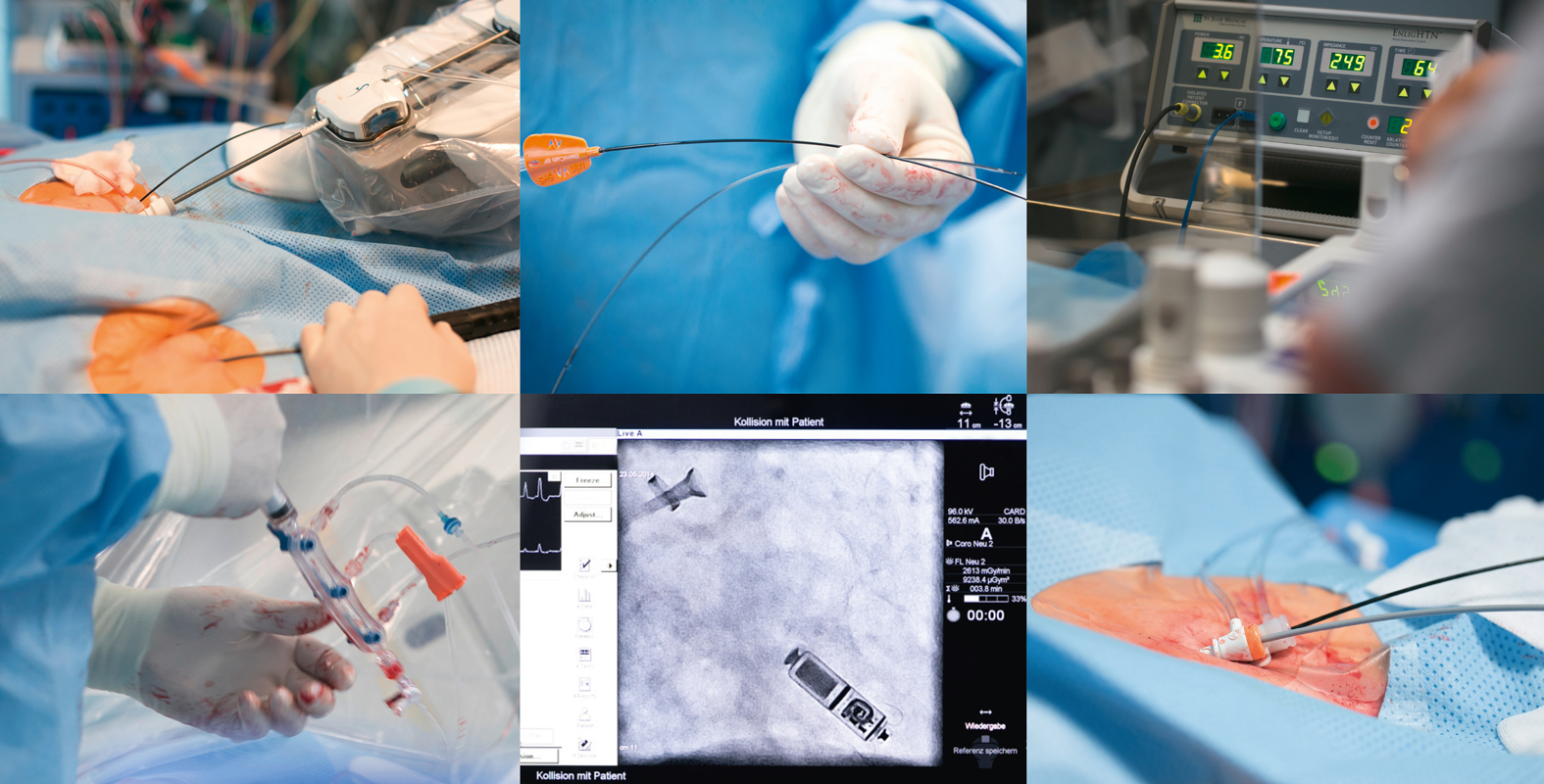 Bild von Operationssituationen in der Kardiologie