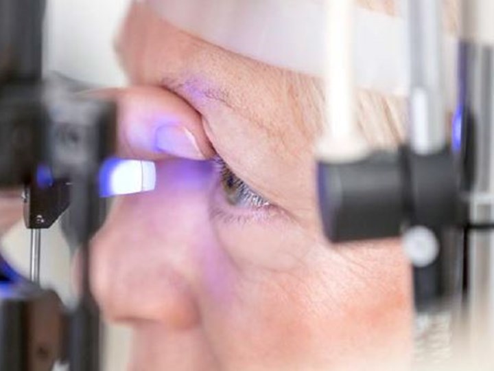 Augenuntersuchung mit der Spaltlampe