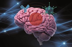 Enzephalitis Abbildung des Gehirns